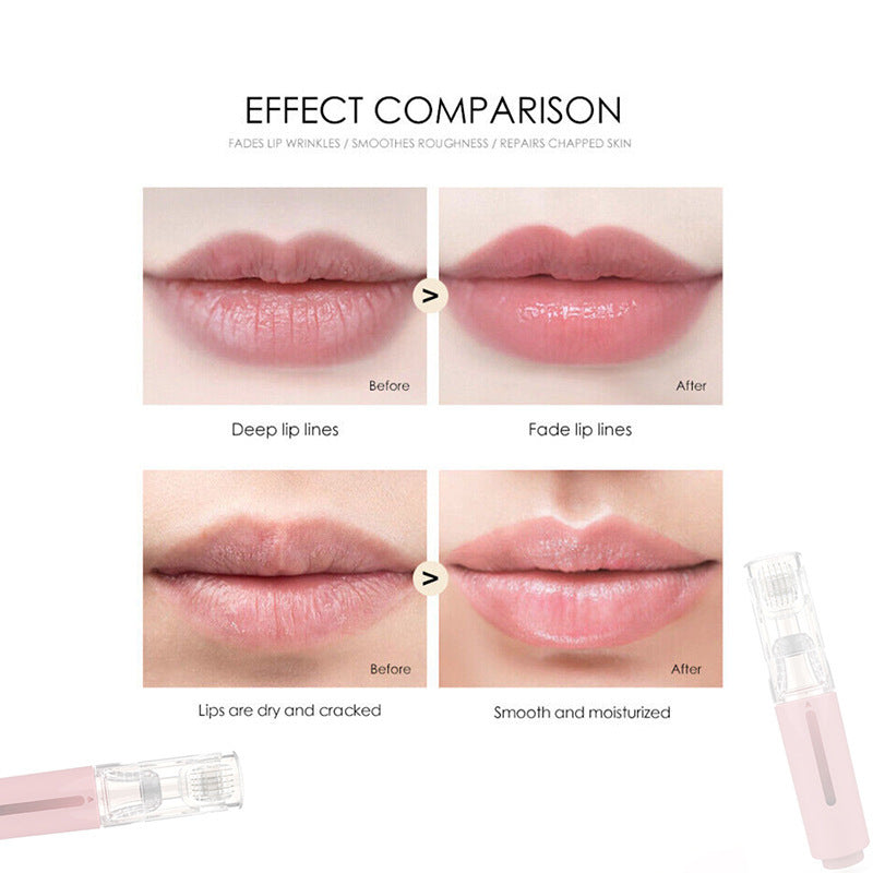 LipBoost Pro – Fuller, Plumper Lips in Minutes